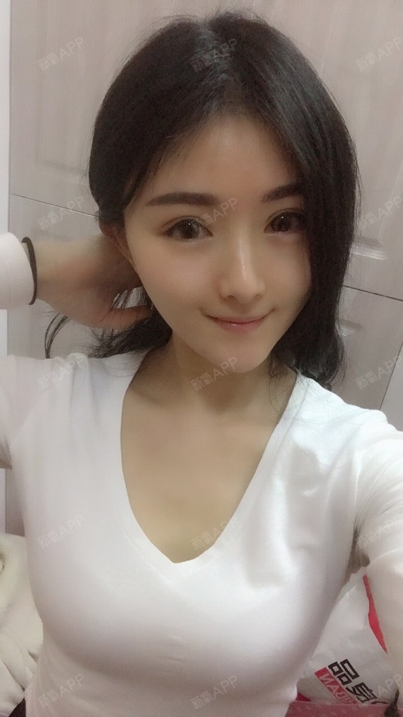 小毛妹呀呀呀呀呀定点双眼皮第19天美丽日记