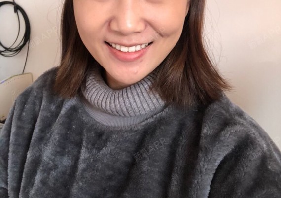 笑起来两边脸颊严重不对称_圈子-新氧美容整形