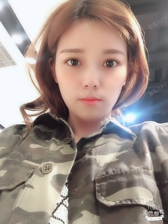 咕叽咕叽叽埋线提升第78天美丽日记-新氧美容