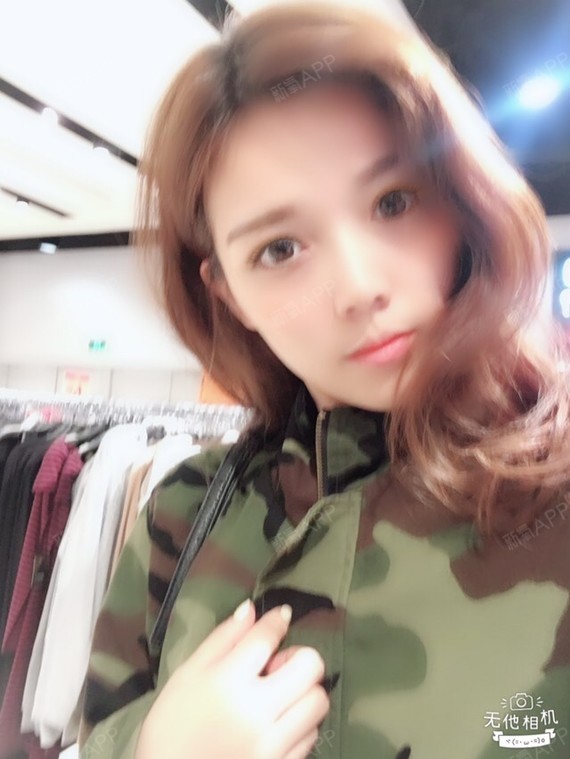 咕叽咕叽叽埋线提升第78天美丽日记-新氧美容