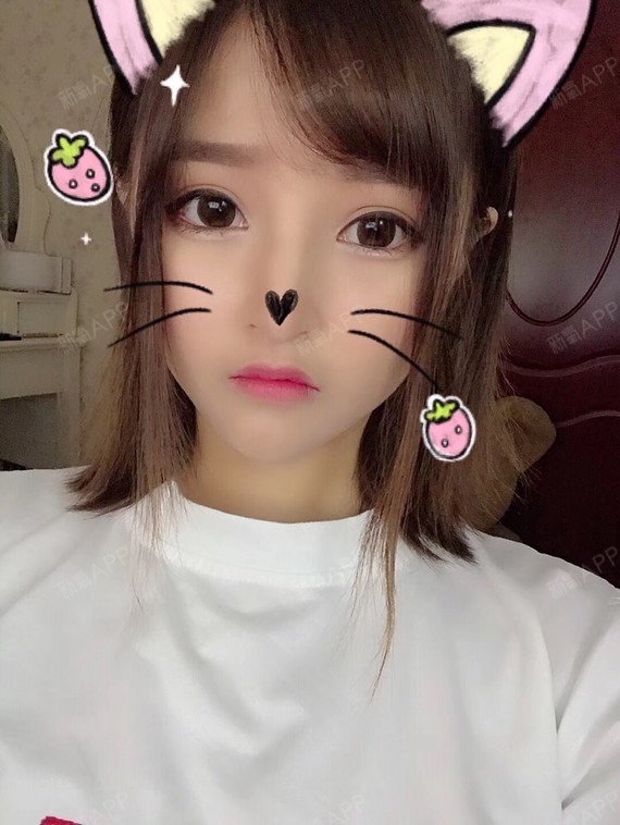 新氧- 姜还是老的辣23 | 眼部 | 开眼角 | 双眼皮 | 开外眼角 | 切开