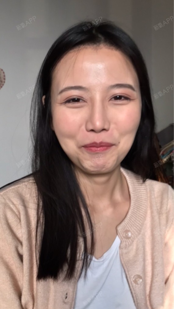 泡泡是条鱼宽鼻矫正第607天美丽日记-新氧美容