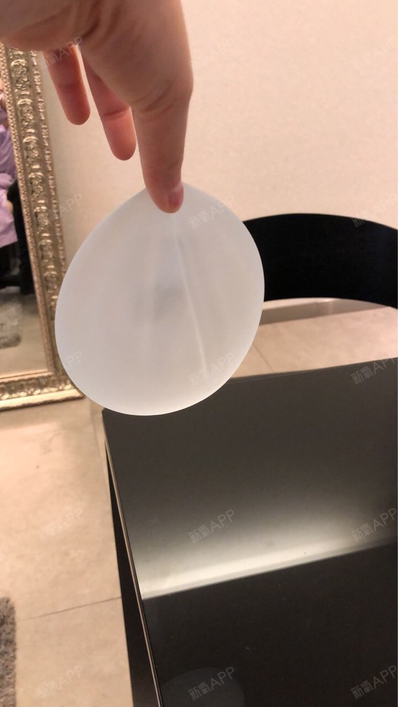 假体隆胸