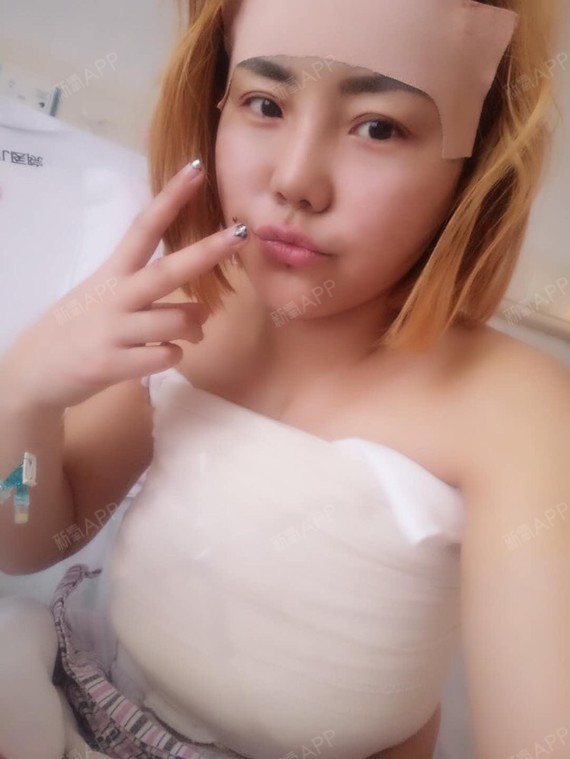 新氧-儿童小公举|脂肪情趣填充全脸|术后当自强|重庆同城v儿童的情趣诗自体图片