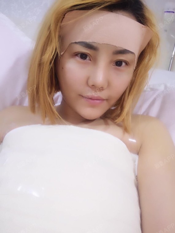 新氧-情趣小公举|情趣脂肪填充全脸|术后当自强|重庆同城片av自体在线观看mp4图片