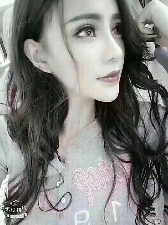 打玻尿酸注意事项:?1注射后7天内不可强烈日晒