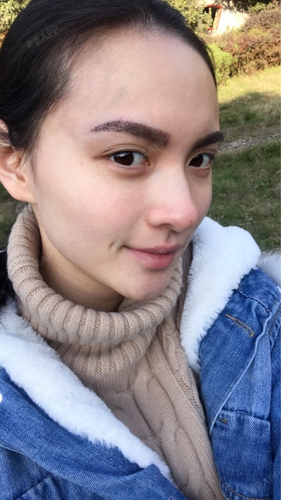 种植眉毛