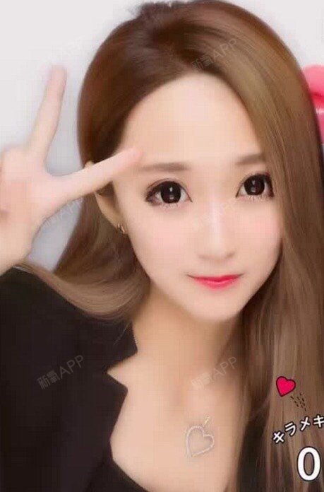 蠢子子下眼下至术第47天美丽日记