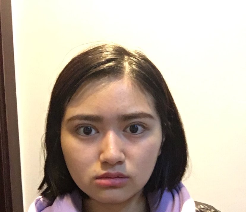 脸歪不标致大小脸求分析该怎么整