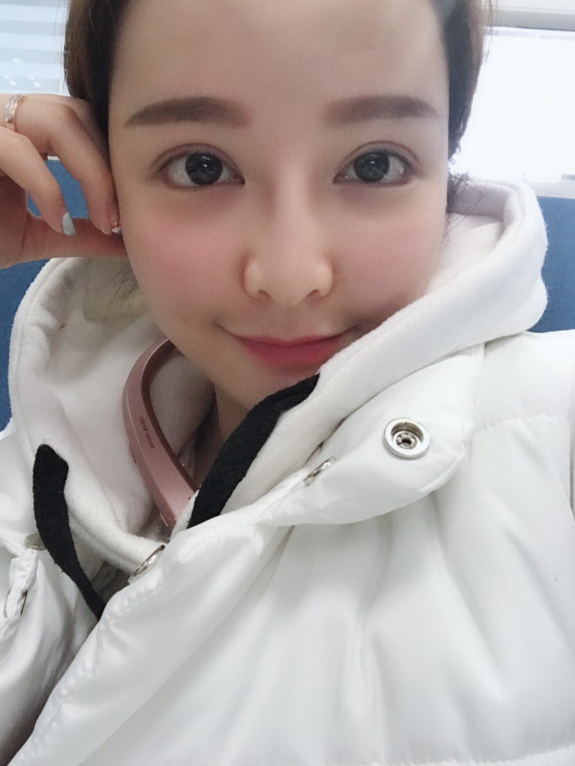 开外眼角怎么样_恢复过程_效果如何_来自非洲的大美女