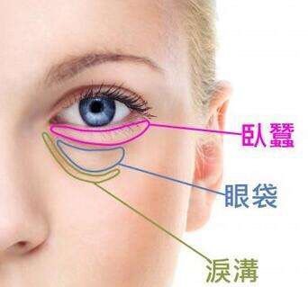 【上海奉浦&祛眼袋】眼袋手术后下凹陷是什么