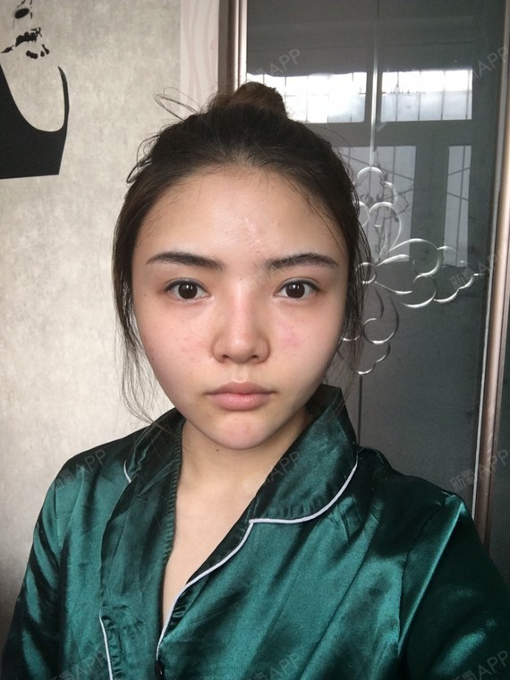 我可能属于近看还比较好看,远看可丑脸可大的那种,超级不上相……想做