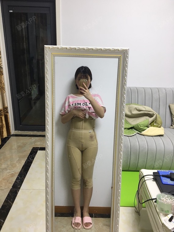 新氧- 前任栗子岳 | 美体塑形 | 吸脂瘦腹部 | 吸脂瘦大腿 | 吸脂瘦
