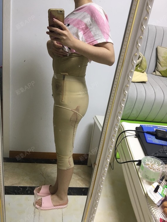 新氧- 前任栗子岳 | 美体塑形 | 吸脂瘦腹部 | 吸脂瘦大腿 | 吸脂瘦