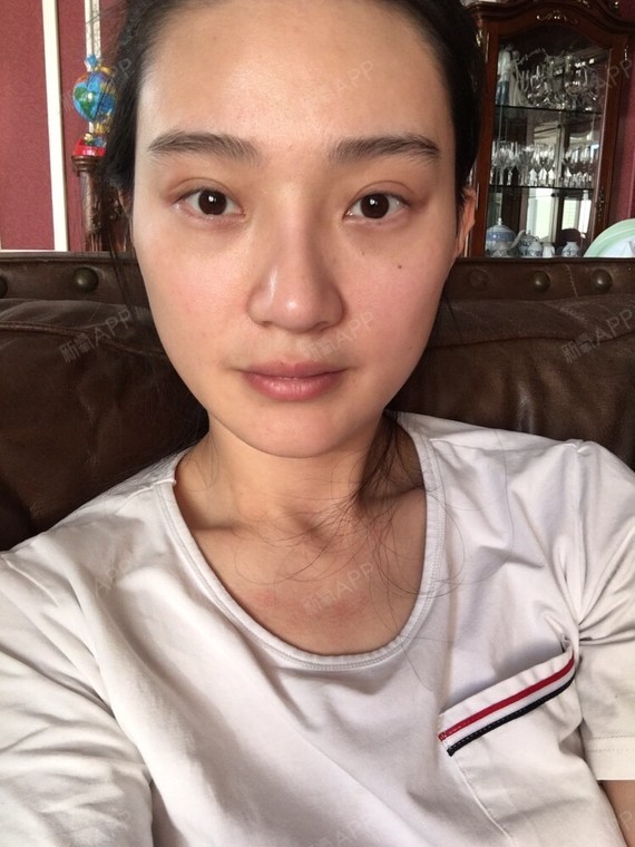 第五天了 已经开始无力 肌肉开始软化 但是没有嘬腮 很满意 期待后期