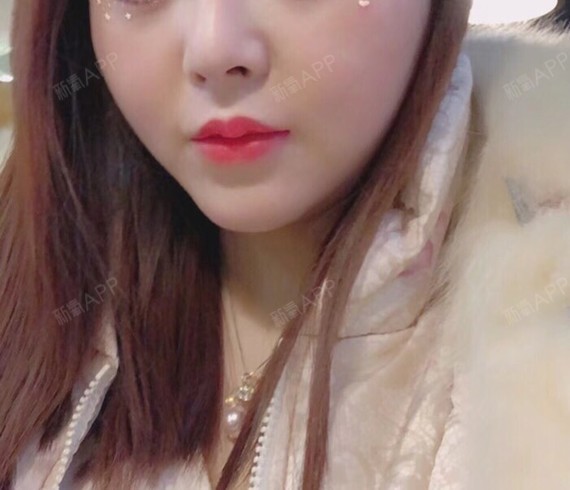 m唇手术