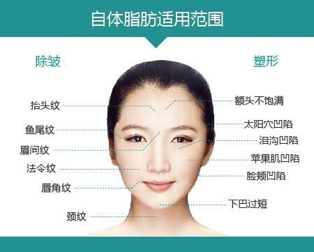 【福州比华利】 面部自体脂肪填充术必知建议