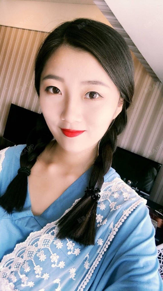 行走的蒙娜丽莎自体脂肪丰太阳穴第15天美丽