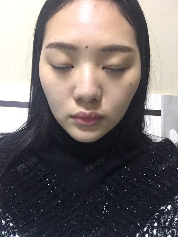 年龄24居住地温州职业化妆师想改善鼻子百达