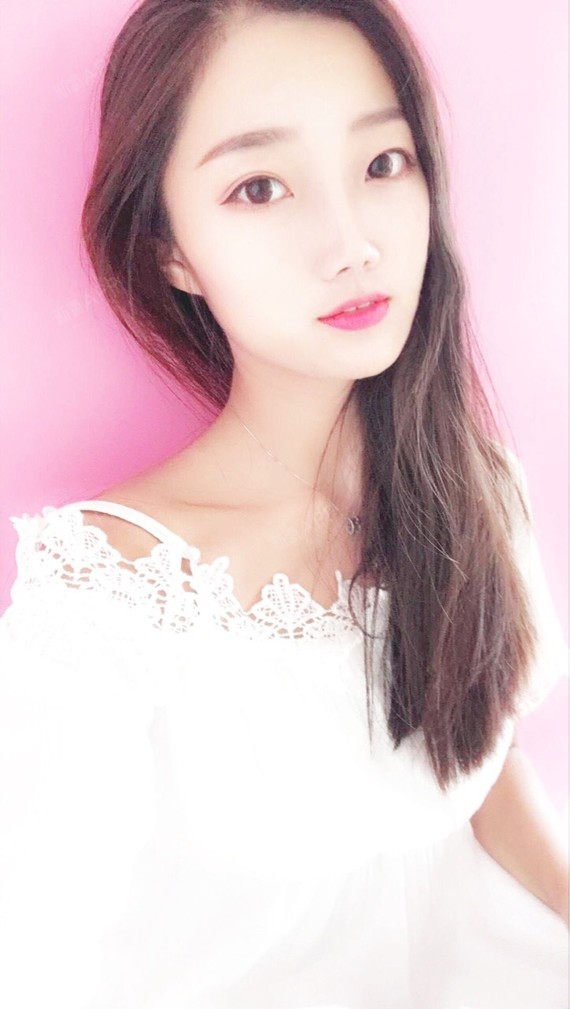 行走的蒙娜丽莎自体脂肪丰太阳穴第25天美丽