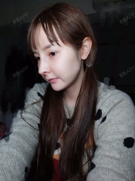 来自非洲的大美女硅胶隆鼻术后第26天美丽日记_新氧