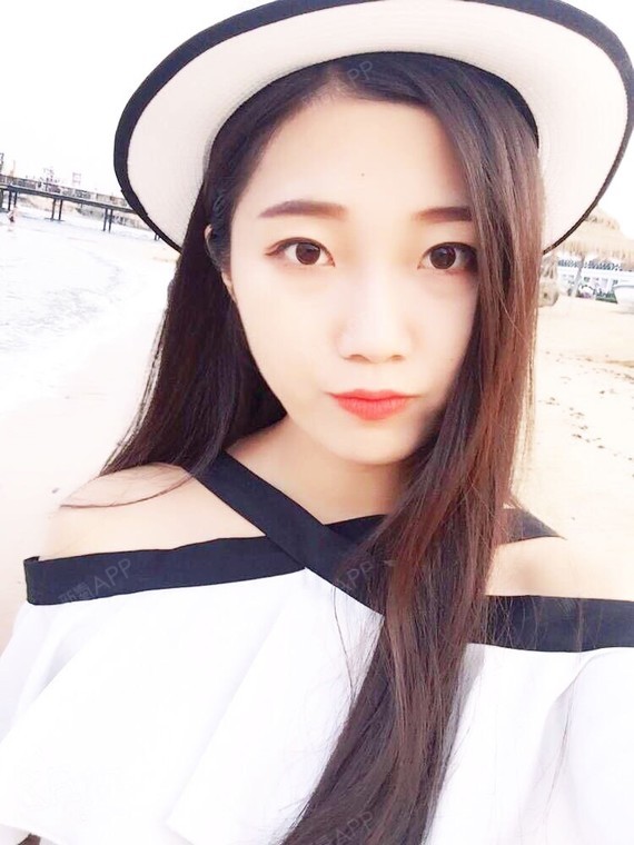 行走的蒙娜丽莎自体脂肪丰太阳穴第15天美丽