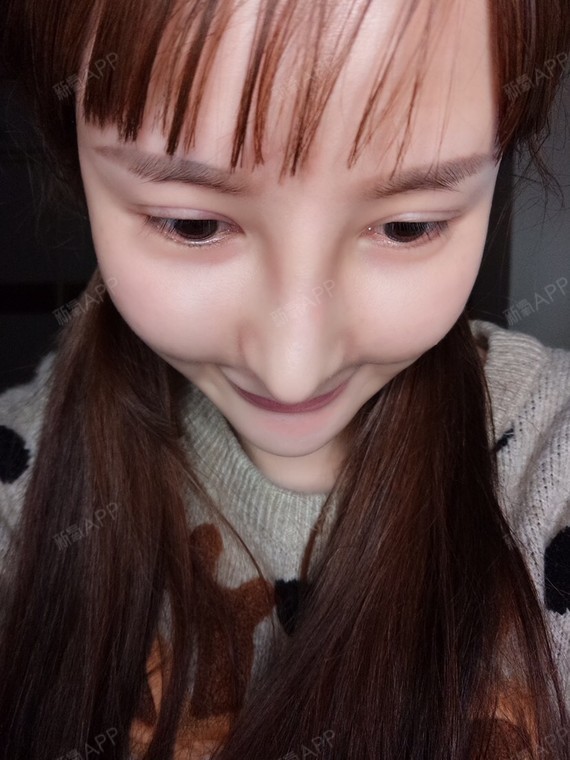来自非洲的大美女硅胶隆鼻术后第26天美丽日记_新氧