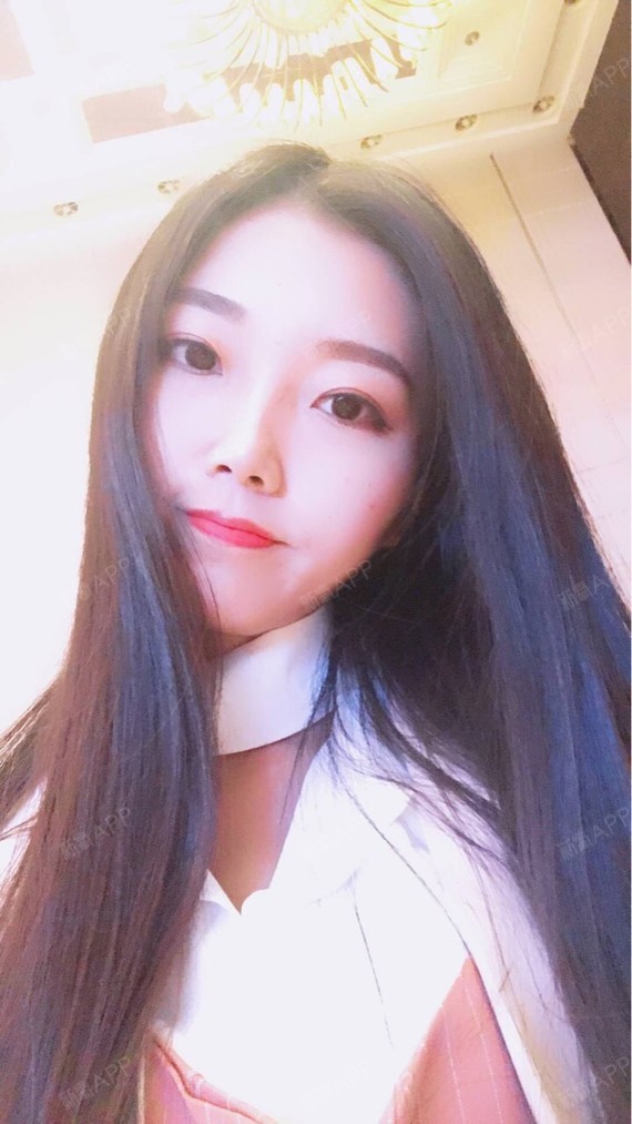 行走的蒙娜丽莎自体脂肪丰太阳穴第7天美丽日