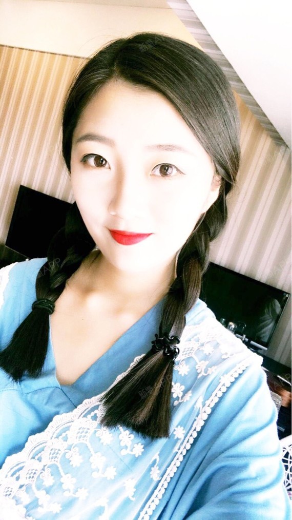 行走的蒙娜丽莎自体脂肪丰太阳穴第15天美丽