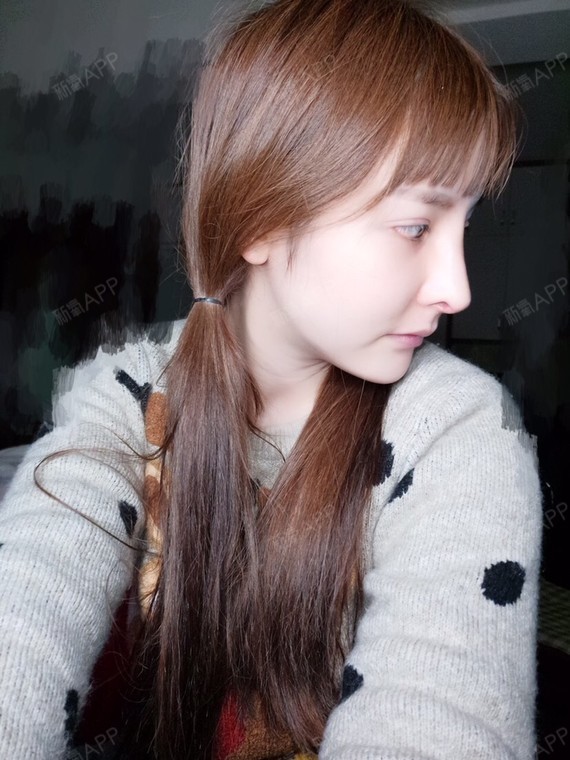 美女 | 鼻部 | 隆鼻 | 硅胶隆鼻 | 术后当自强 | 鼻骨矫正 | 驼峰鼻