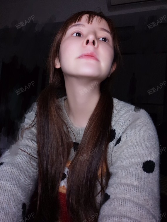 美女 | 鼻部 | 隆鼻 | 硅胶隆鼻 | 术后当自强 | 鼻骨矫正 | 驼峰鼻