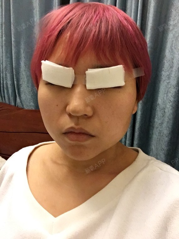 术后纱布包扎