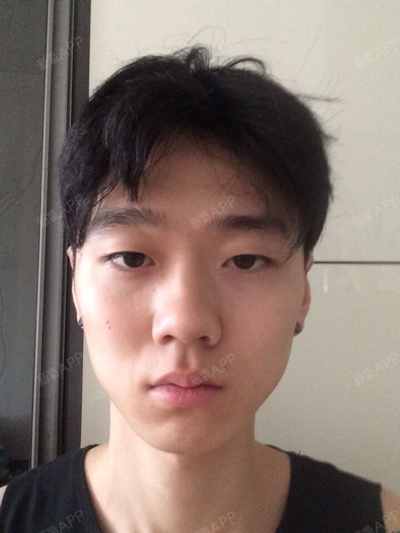 韩国DA整形医院专属男性的整形方案男士面部