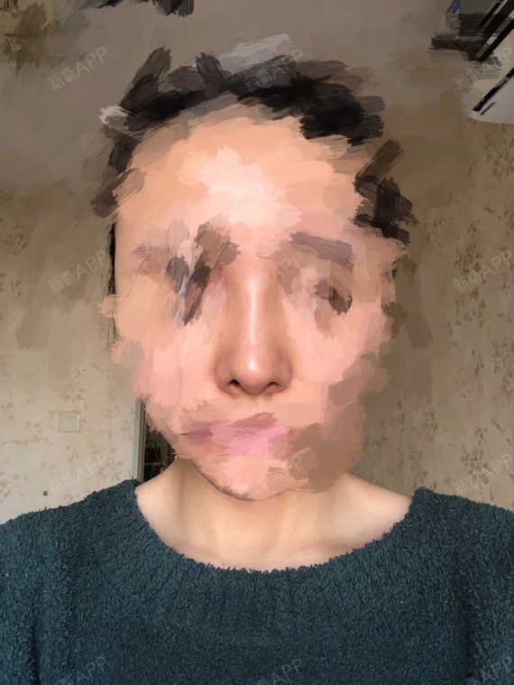 鼻孔一个大一个小.