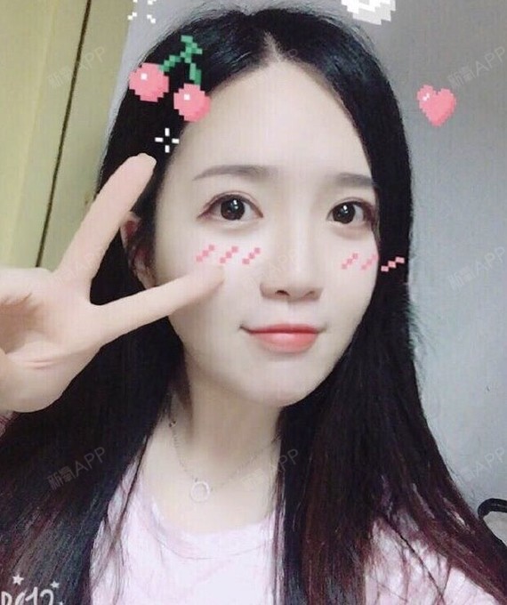 乔帮主jj美白导入第0天美丽日记-新氧美容整形