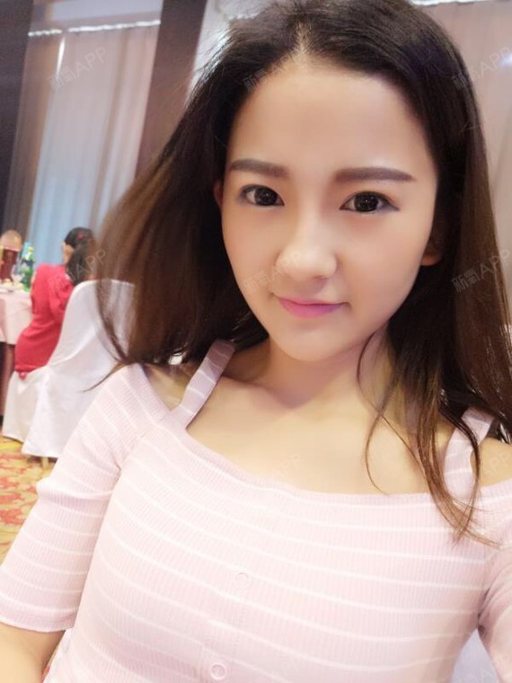 埋线法(亦有称之为高分子成型法),是通过缝合方