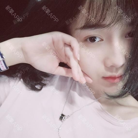 【美莱整形20周年庆】硅胶隆鼻手术恢复时间