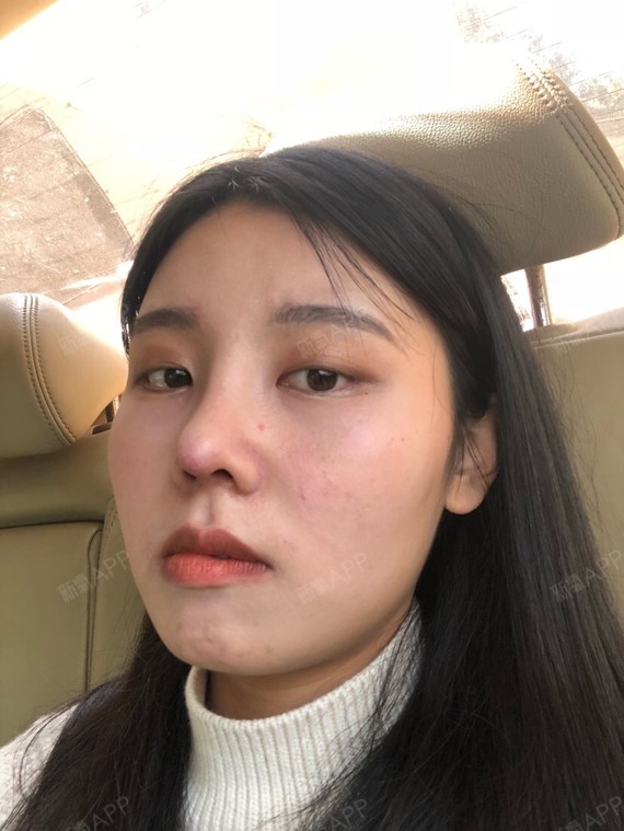 嗯鼻头还是很尖很高很奇怪从开始就很尖人家_圈子