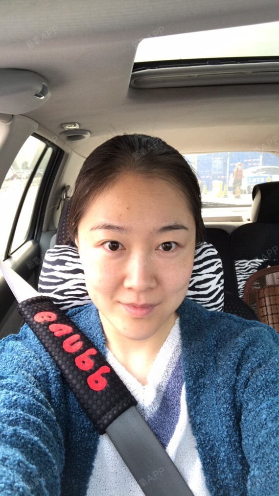 时光机器呀埋线提升第57天美丽日记-新氧美容