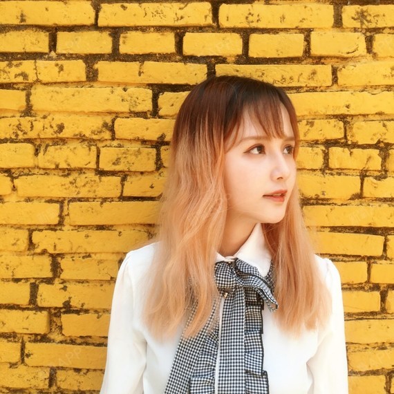 咪咪眼儿开内眼角第86天美丽日记-新氧美容整