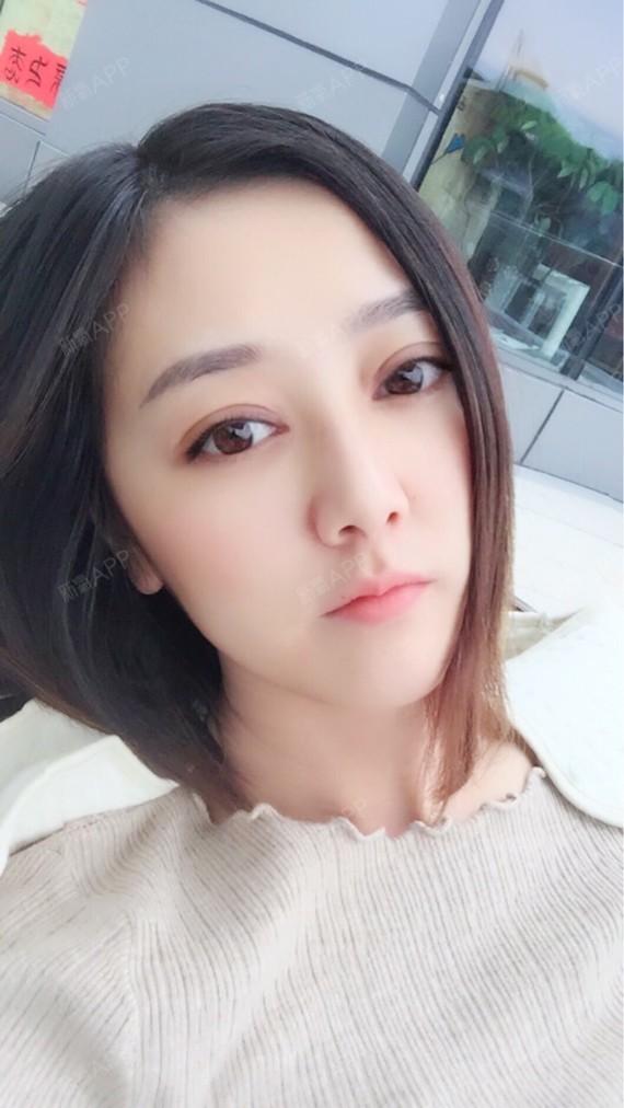 现在其实也不是做了很久,也就一个月点,帕克双眼皮会比一般双眼皮