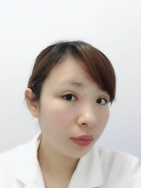 男生们是非开内眼角第31天美丽日记-新氧美容