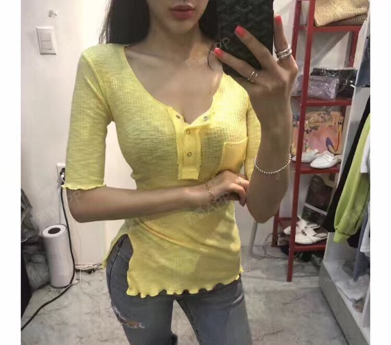 ε仙女有对小翅膀з射频溶脂瘦腰部第247天美丽日记-新氧美容整形