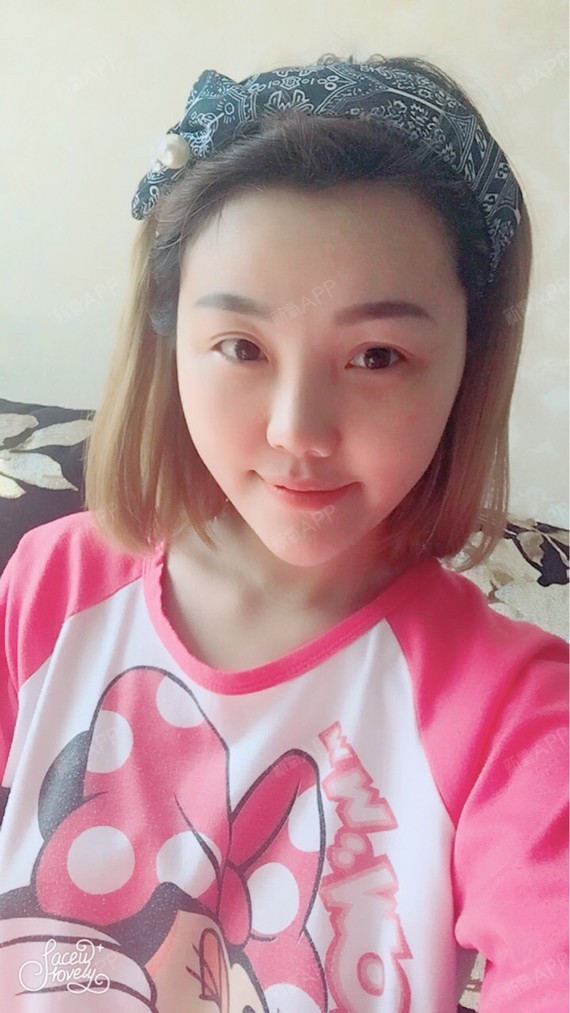 新氧-情趣小公举|胸部|隆胸|假体隆胸|术后当自强|北京臀情趣各式乳試主播翹穿衣內美图片