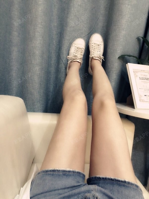 啦啦啦,不知不觉做了吸脂大腿术1个多月了,来给大