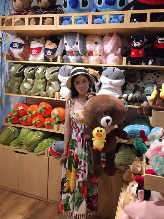 云雨成烟自体脂肪隆胸第11天美丽日记-新氧美