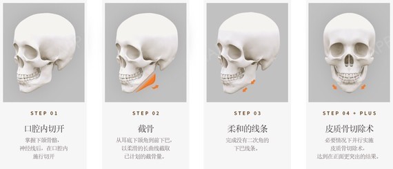 每个人的的面部基础都不同,如何设计出适合自己的脸