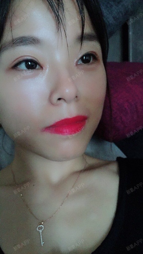 男生们是非开内眼角第20天美丽日记-新氧美容