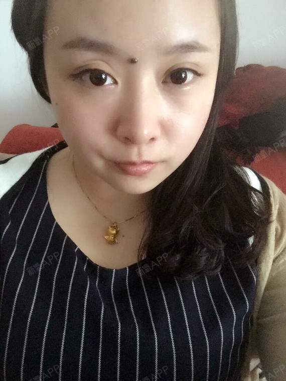 眼睛有点凸,是那种自己一抬眼睛就是双眼皮的