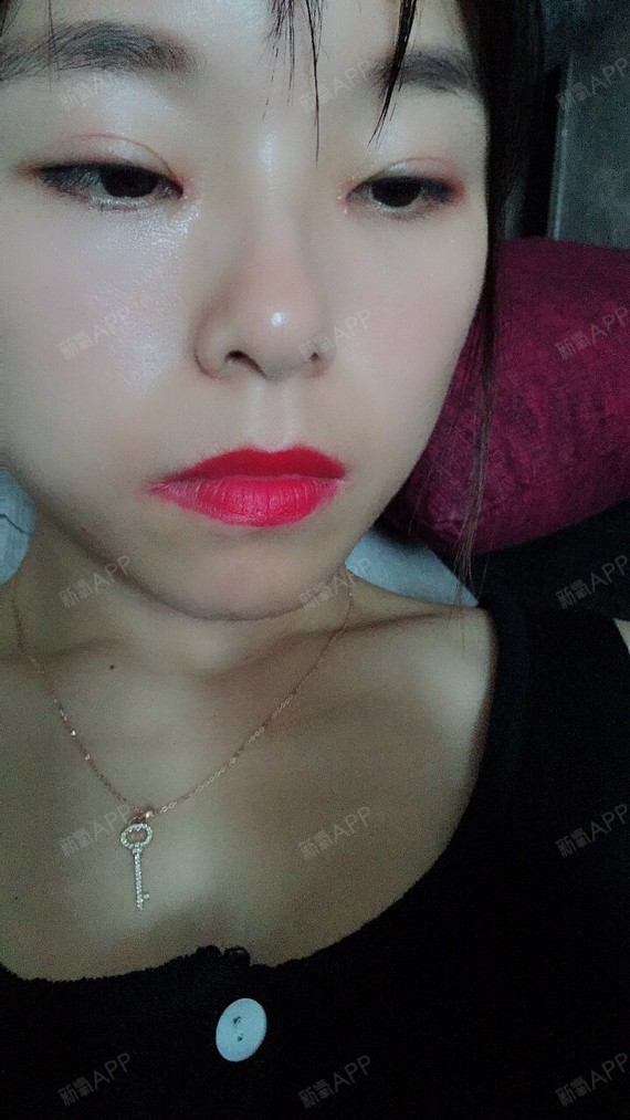 男生们是非开内眼角第20天美丽日记-新氧美容